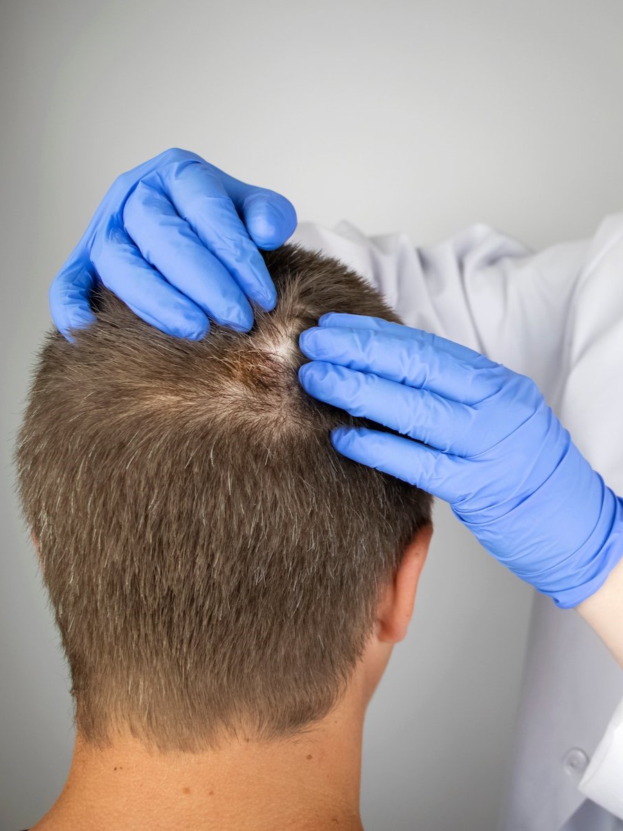 Hair and Scalp Treatment